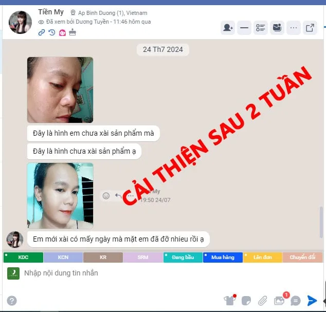 Kem Diếp Cá Dâu Tằm – Cấp Ẩm, Trị Mụn Thâm, Dưỡng Trắng Da